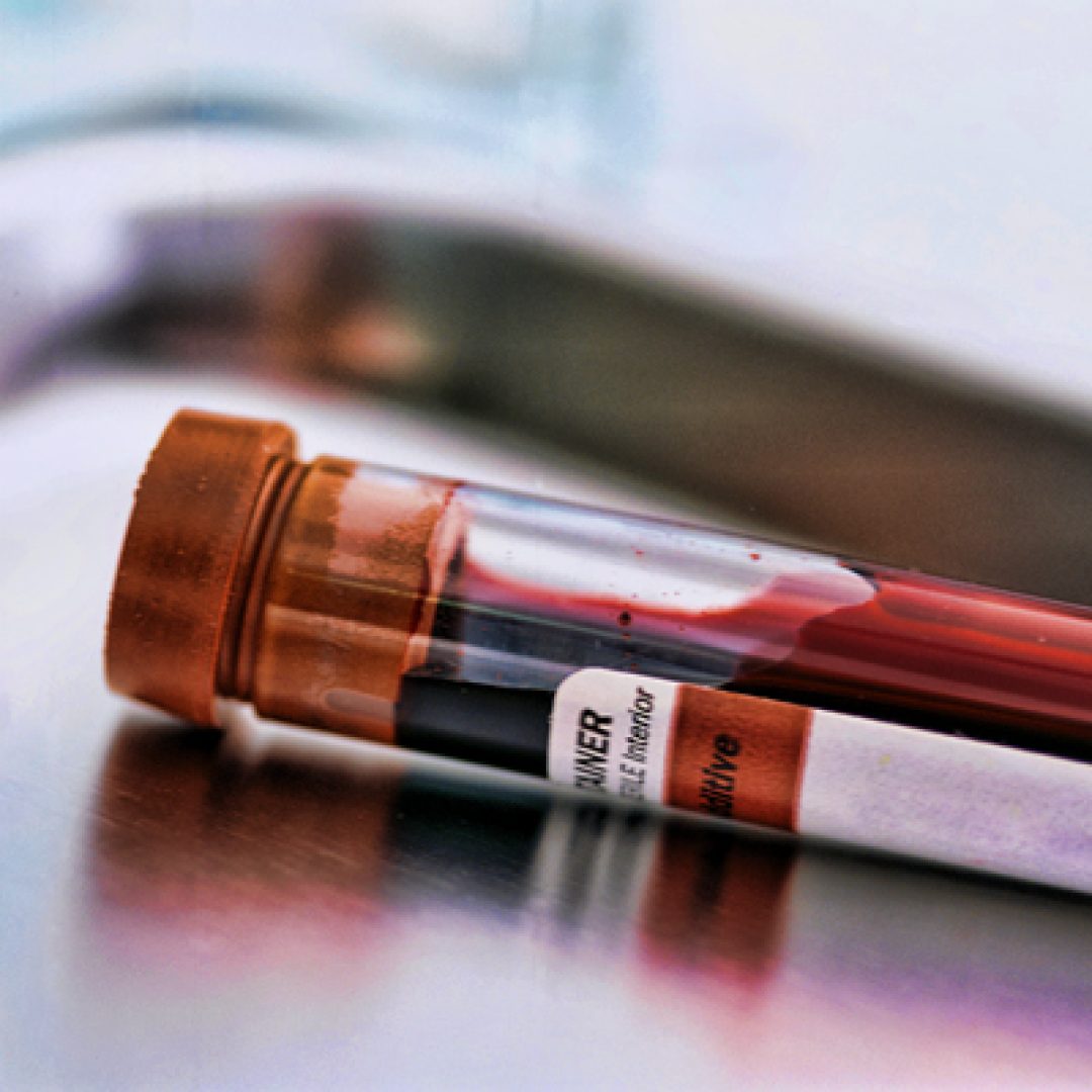 Blood Sample